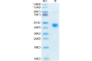 TGFB1 Protein (His-Avi Tag,Biotin)