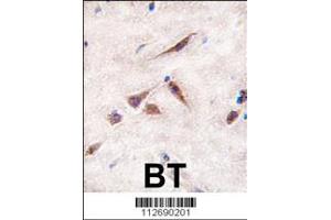 Image no. 3 for anti-ES cell expressed Ras (ERAS) (AA 13-42), (N-Term) antibody (ABIN5534212)