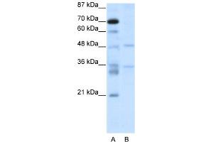 Image no. 1 for anti-Forkhead Box N2 (FOXN2) (C-Term) antibody (ABIN2780406)