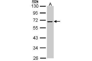 Image no. 2 for anti-Alpha2 Antiplasmin (SERPINF2) (Center) antibody (ABIN2856732)