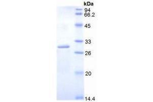 Image no. 1 for Dihydrolipoyl Transacetylase (DLAT) protein (ABIN3009179)