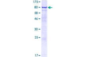 Image no. 1 for AVL9 Homolog (AVL9) (AA 1-463) protein (GST tag) (ABIN1346230)