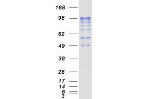 Image no. 1 for phosphodiesterase 4A, CAMP-Specific (PDE4A) (Transcript Variant 4) protein (Myc-DYKDDDDK Tag) (ABIN2728507)
