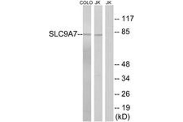 anti-Sodium Hydrogen Exchanger 7 (SLC9A7) (AA 531-580) antibody