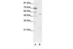 Image no. 1 for anti-Homeobox even-skipped homolog protein 2 (EVX2) (AA 63-112) antibody (ABIN203247)