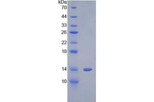 Image no. 1 for Cystatin-Like 1 (CSTL1) protein (ABIN3009086)
