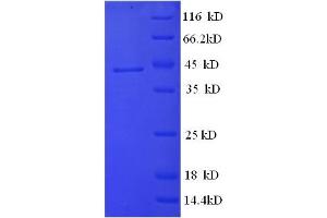 Image no. 1 for serpin Peptidase Inhibitor, Clade A (Alpha-1 Antiproteinase, Antitrypsin), Member 6 (SERPINA6) (AA 23-405) protein (GST tag) (ABIN5710336)