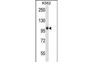 Image no. 1 for anti-PTK2B Protein tyrosine Kinase 2 beta (PTK2B) (AA 672-701) antibody (ABIN5535571)