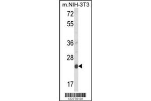 Western Blotting (WB) image for anti-Der1-Like Domain Family, Member 1 (DERL1) antibody (ABIN2158531)