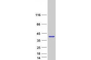 Image no. 1 for Sulfotransferase Family, Cytosolic, 1A, Phenol-Preferring, Member 4 (SULT1A4) (Transcript Variant 1) protein (Myc-DYKDDDDK Tag) (ABIN2732935)