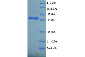 Image no. 1 for Dual Specificity Phosphatase 26 (DUSP26) (AA 1-211), (full length) protein (His-SUMO Tag) (ABIN5711773)