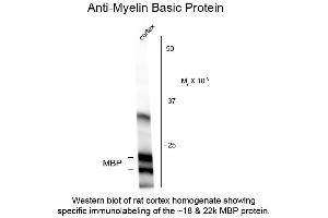 Image no. 1 for anti-Myelin Basic Protein (MBP) antibody (ABIN6658054)