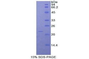 Image no. 1 for Nitric Oxide Synthase 2, Inducible (NOS2) (AA 518-694) protein (His tag) (ABIN1877324)