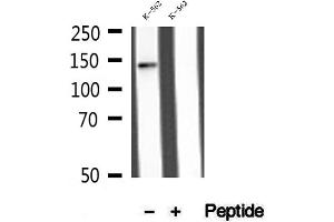 Image no. 2 for anti-MLX Interacting Protein (MLXIP) (N-Term) antibody (ABIN6263283)