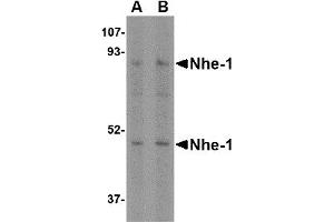 Western Blotting (WB) image for anti-Solute Carrier Family 9, Subfamily A (NHE1, Cation Proton Antiporter 1), Member 1 (SLC9A1) (Middle Region) antibody (ABIN1031013)