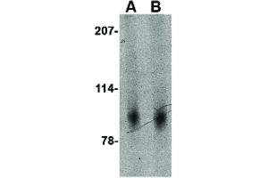 Image no. 1 for anti-SLIT and NTRK-Like Family, Member 2 (SLITRK2) (Internal Region) antibody (ABIN6656785)