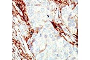 Image no. 3 for anti-Fibroblast Growth Factor Receptor 1 (FGFR1) (AA 19-48) antibody (ABIN3030945)