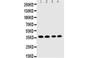 Image no. 2 for anti-Eukaryotic Translation Initiation Factor 2 Subunit 1 (EIF2S1) (AA 123-137), (Middle Region) antibody (ABIN3044058)