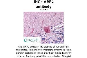 Image no. 1 for anti-Actin Related Protein 2/3 Complex, Subunit 1B, 41kDa (ARPC1B) (AA 40-311) antibody (ABIN1731960)
