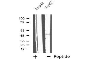 Image no. 1 for anti-Interleukin 13 Receptor, alpha 2 (IL13RA2) (C-Term) antibody (ABIN6257040)