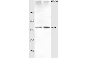 Lane 1: rat heart Lane 2: rat liver lysates probed with Anti SNAI2/SLUG Polyclonal Antibody, Unconjugated (ABIN685747) at 1:200 in 4 °C.