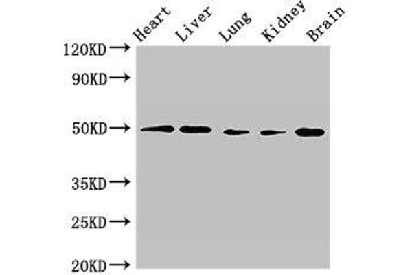 GPR22 抗体  (AA 246-307)