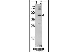 Image no. 1 for anti-Mevalonate (Diphospho) Decarboxylase (MVD) (AA 7-34), (N-Term) antibody (ABIN390673)