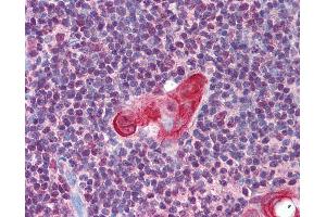 Image no. 2 for anti-T-Cell Leukemia Homeobox 1 (TLX1) (AA 300-330), (AA 306-318) antibody (ABIN297247)