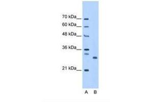 Image no. 1 for anti-PSMC3 Interacting Protein (PSMC3IP) (AA 143-192) antibody (ABIN321308)
