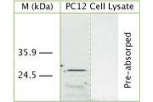 Image no. 1 for anti-DNA-Damage Regulated Autophagy Modulator 1 (DRAM1) (N-Term) antibody (ABIN350296)