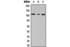 Image no. 1 for anti-TBC1 Domain Family, Member 2 (TBC1D2) (Center) antibody (ABIN2707143)