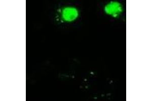 Image no. 1 for anti-V-Akt Murine Thymoma Viral Oncogene Homolog 3 (Protein Kinase B, Gamma) (AKT3) antibody (ABIN2715859)
