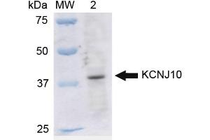 KCNJ10 Antikörper  (FITC)