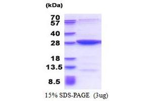 Image no. 1 for MOB Kinase Activator 3B (MOB3B) (AA 1-216) protein (His tag) (ABIN5853502)