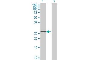 Image no. 1 for anti-Zinc Finger, C4H2 Domain Containing (ZC4H2) (AA 1-224) antibody (ABIN527788)