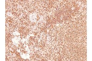 Image no. 8 for anti-Linker For Activation of T Cells (LAT) (pTyr161) antibody (ABIN6271566)