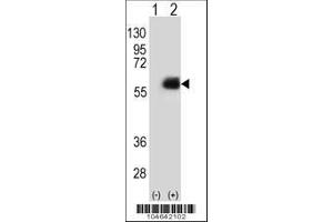 Image no. 3 for anti-N-Myristoyltransferase 2 (NMT2) (AA 16-46), (N-Term) antibody (ABIN389095)