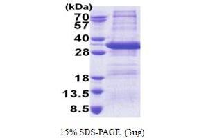 Image no. 1 for Syntaxin 17 (STX17) (AA 1-229) protein (His tag) (ABIN5853261)