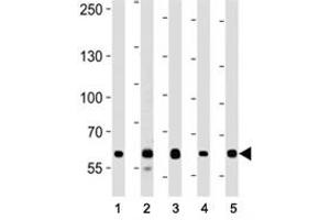 Image no. 5 for anti-Forkhead Box P1 (FOXP1) (AA 650-677) antibody (ABIN3030993)