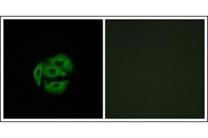 Image no. 1 for anti-Cytochrome P450, Family 39, Subfamily A, Polypeptide 1 (CYP39A1) (C-Term) antibody (ABIN951785)