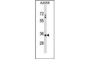 Image no. 2 for anti-Spermatid Maturation 1 (SPEM1) (AA 114-144), (Middle Region) antibody (ABIN954923)
