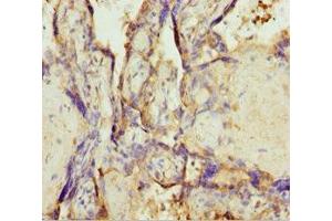 Immunohistochemistry of paraffin-embedded human placenta tissue using ABIN7173219 at dilution of 1:100