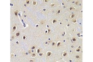 Immunohistochemistry of paraffin-embedded Rat brain using CDKN1B Polyclonal Antibody at dilution of 1:200 (40x lens).