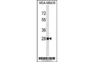 Image no. 1 for anti-Small Nuclear Ribonucleoprotein Polypeptide B (SNRPB2) (AA 1-30), (N-Term) antibody (ABIN656315)