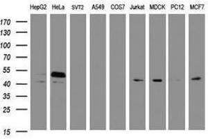 Image no. 4 for anti-SERPINE1 mRNA Binding Protein 1 (SERBP1) (AA 1-262) antibody (ABIN1490678)