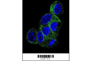 Image no. 1 for anti-Tubulin, beta 1 (TUBB1) antibody (ABIN658975)