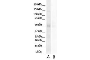 Image no. 7 for anti-Hepatocyte Nuclear Factor 4, alpha (HNF4A) (N-Term) antibody (ABIN2777514)