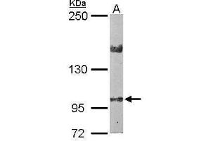 Image no. 2 for anti-LIM and Calponin Homology Domains 1 (LIMCH1) (C-Term) antibody (ABIN2856627)