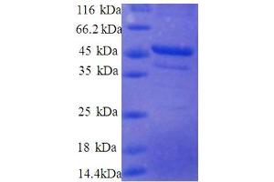 Image no. 1 for Ribosomal Protein S10 (RPS10) (AA 4-165), (partial) protein (GST tag) (ABIN5712243)