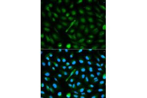 Image no. 3 for anti-alpha-2-HS-Glycoprotein (AHSG) antibody (ABIN3022317)
